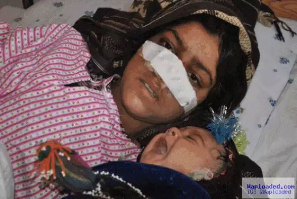 Afghan man cuts off his wife’s nose in a fit of rage (Photo)